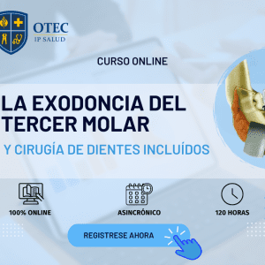 LA EXODONCIA DEL TERCER  MOLAR Y DIENTES INCLUÍDOS
